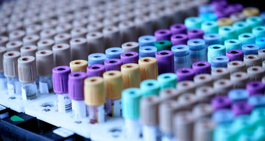 A tray of vials. By Testalize.me on unsplash